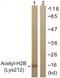 Histone H2B antibody, LS-C120508, Lifespan Biosciences, Western Blot image 
