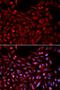 Nuclear receptor subfamily 1 group I member 3 antibody, LS-C331796, Lifespan Biosciences, Immunofluorescence image 