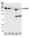 Ribosome Binding Protein 1 antibody, A303-997A, Bethyl Labs, Western Blot image 