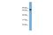 Zinc Finger Protein 599 antibody, PA5-69688, Invitrogen Antibodies, Western Blot image 