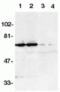 TNF Receptor Superfamily Member 21 antibody, TA306010, Origene, Western Blot image 