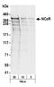 Nuclear Receptor Corepressor 1 antibody, A301-146A, Bethyl Labs, Western Blot image 