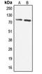 Coenzyme Q8A antibody, MBS820799, MyBioSource, Western Blot image 
