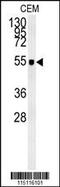 Zic Family Member 3 antibody, 61-491, ProSci, Western Blot image 