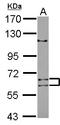 Adenosine Deaminase Domain Containing 1 antibody, LS-C155652, Lifespan Biosciences, Western Blot image 