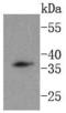 Dickkopf WNT Signaling Pathway Inhibitor 1 antibody, A00632-2, Boster Biological Technology, Western Blot image 