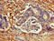 Cyclin-dependent kinase 4 inhibitor C antibody, orb47982, Biorbyt, Immunohistochemistry paraffin image 
