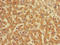 CutA Divalent Cation Tolerance Homolog antibody, LS-C677618, Lifespan Biosciences, Immunohistochemistry paraffin image 