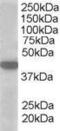 Solute Carrier Family 16 Member 7 antibody, GTX89697, GeneTex, Western Blot image 