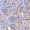 KI-67 antibody, A2094, ABclonal Technology, Immunohistochemistry paraffin image 