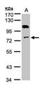 Adenylate Kinase 7 antibody, NBP1-32560, Novus Biologicals, Western Blot image 
