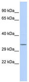 NmrA-like family domain-containing protein 1 antibody, TA344312, Origene, Western Blot image 