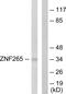 Zinc Finger RANBP2-Type Containing 2 antibody, PA5-38555, Invitrogen Antibodies, Western Blot image 