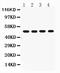FAS antibody, PA5-79236, Invitrogen Antibodies, Western Blot image 