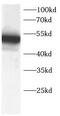 RAGE antibody, FNab10403, FineTest, Western Blot image 