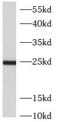 ADP-ribosylation factor-like protein 5B antibody, FNab00579, FineTest, Western Blot image 
