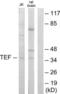 TEF Transcription Factor, PAR BZIP Family Member antibody, LS-C119000, Lifespan Biosciences, Western Blot image 