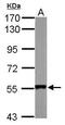 SET And MYND Domain Containing 1 antibody, PA5-31482, Invitrogen Antibodies, Western Blot image 