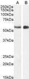 Serine/Threonine Kinase 35 antibody, PA5-18247, Invitrogen Antibodies, Western Blot image 