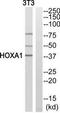 Homeobox protein Hox-A1 antibody, TA314023, Origene, Western Blot image 