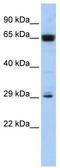 Chromosome 6 Open Reading Frame 223 antibody, TA330934, Origene, Western Blot image 