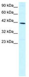 Forkhead box protein F2 antibody, TA329389, Origene, Western Blot image 