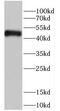 Carnosine N-Methyltransferase 1 antibody, FNab01144, FineTest, Western Blot image 