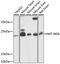 Mitochondrially Encoded NADH:Ubiquinone Oxidoreductase Core Subunit 6 antibody, 18-182, ProSci, Western Blot image 