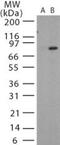 Protective antigen antibody, PA1-41695, Invitrogen Antibodies, Western Blot image 