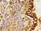 CD208 antibody, CSB-PA892177LA01HU, Cusabio, Immunohistochemistry paraffin image 