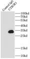 Cytochrome B5 Reductase 3 antibody, FNab02116, FineTest, Immunoprecipitation image 