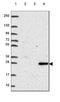 Ribonuclease T2 antibody, NBP2-49484, Novus Biologicals, Western Blot image 
