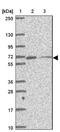 Myosin Light Chain Kinase 2 antibody, NBP2-32489, Novus Biologicals, Western Blot image 
