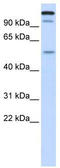 Ubiquitin Like With PHD And Ring Finger Domains 2 antibody, TA337254, Origene, Western Blot image 