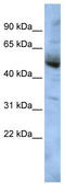 COP9 Signalosome Subunit 4 antibody, TA345062, Origene, Western Blot image 