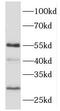 Cytosolic Iron-Sulfur Assembly Component 3 antibody, FNab05552, FineTest, Western Blot image 
