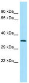 SPG21 Abhydrolase Domain Containing, Maspardin antibody, TA338043, Origene, Western Blot image 
