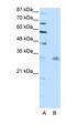 Pituitary homeobox 3 antibody, orb329991, Biorbyt, Western Blot image 