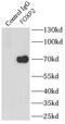 Forkhead Box P2 antibody, FNab03207, FineTest, Immunoprecipitation image 