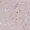 Immunoglobulin Superfamily Containing Leucine Rich Repeat 2 antibody, HPA067333, Atlas Antibodies, Immunohistochemistry frozen image 