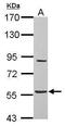 Abhydrolase Domain Containing 16A antibody, GTX119080, GeneTex, Western Blot image 