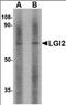 Leucine-rich repeat LGI family member 2 antibody, orb94252, Biorbyt, Western Blot image 