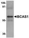 Breast Carcinoma Amplified Sequence 1 antibody, A13589, Boster Biological Technology, Western Blot image 