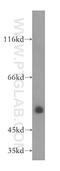 Beta 3-Glucosyltransferase antibody, 14601-1-AP, Proteintech Group, Western Blot image 
