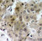 Kinase Insert Domain Receptor antibody, AP0382, ABclonal Technology, Immunohistochemistry paraffin image 