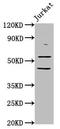 Cholinergic Receptor Nicotinic Beta 2 Subunit antibody, LS-C670793, Lifespan Biosciences, Western Blot image 