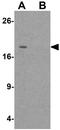 Serine protease inhibitor Kazal-type 2 antibody, GTX32051, GeneTex, Western Blot image 