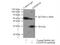 Charged multivesicular body protein 1b antibody, 14639-1-AP, Proteintech Group, Immunoprecipitation image 