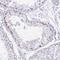 MORC Family CW-Type Zinc Finger 4 antibody, NBP2-33874, Novus Biologicals, Immunohistochemistry frozen image 