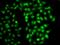 Proteasome 26S Subunit, Non-ATPase 8 antibody, GTX33440, GeneTex, Immunocytochemistry image 